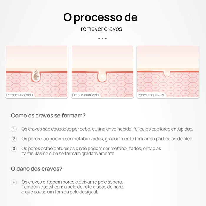 Removedor de Cravos Lanbena® + Brinde Exclusivo