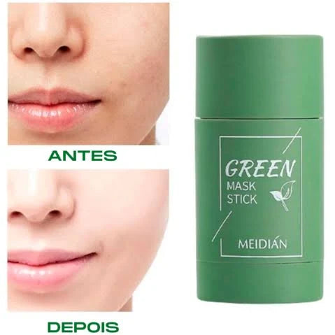 Green Mask - mascara antiacne